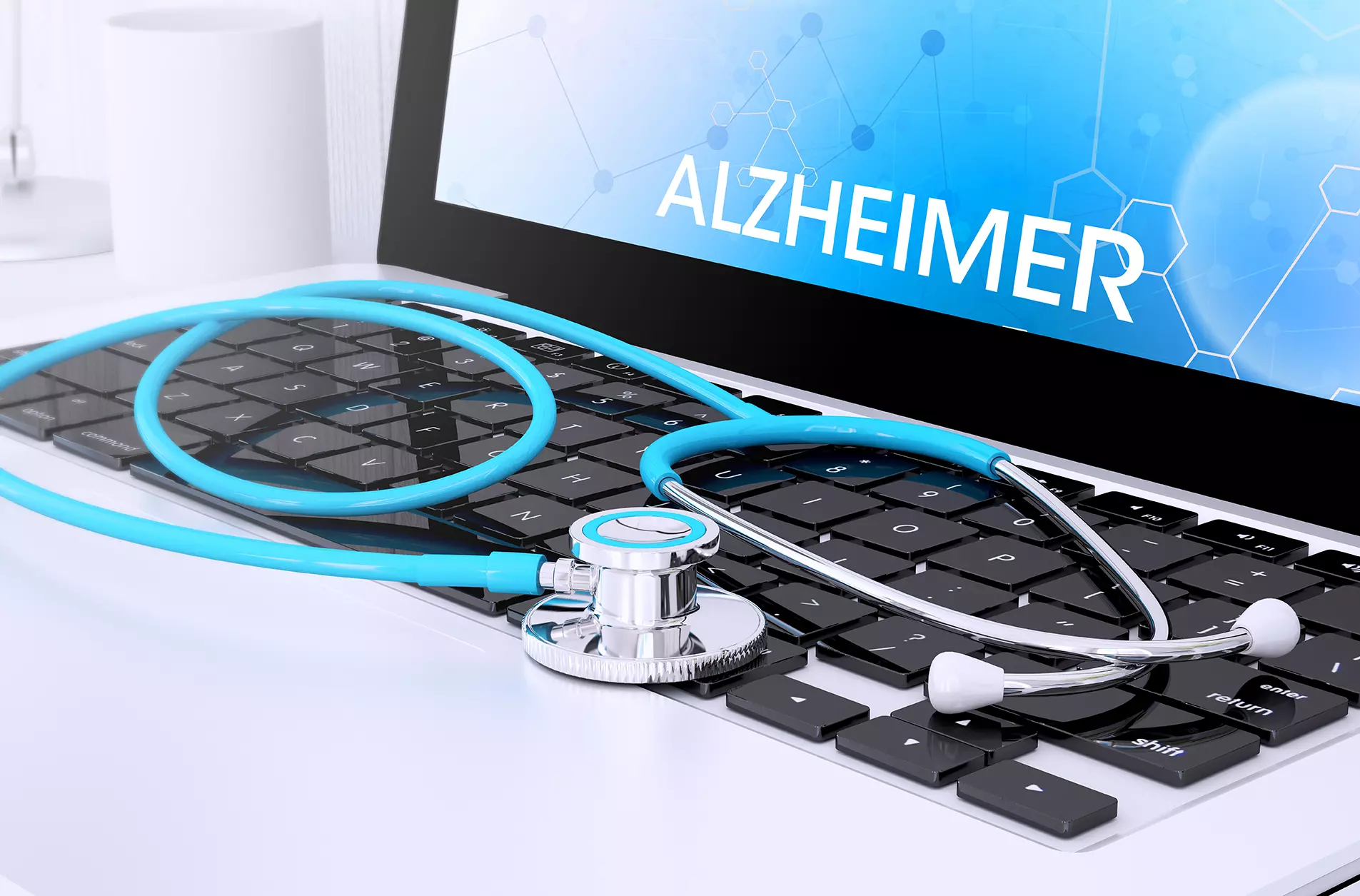 Computadora sobre el teclado un estetoscopio en la pantalla la palabra alzheimer, representando que los investigadores entrenan Inteligencia Artificial para detectar Alzheimer.